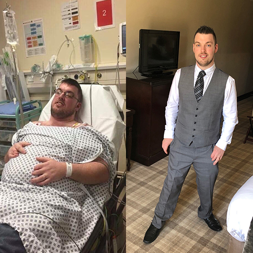 Jamie Woodend 4st weight loss transformation-slimming world blog