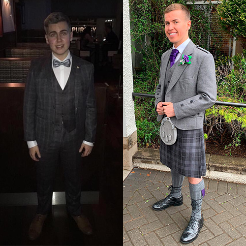 Fraser Walker before and after photos