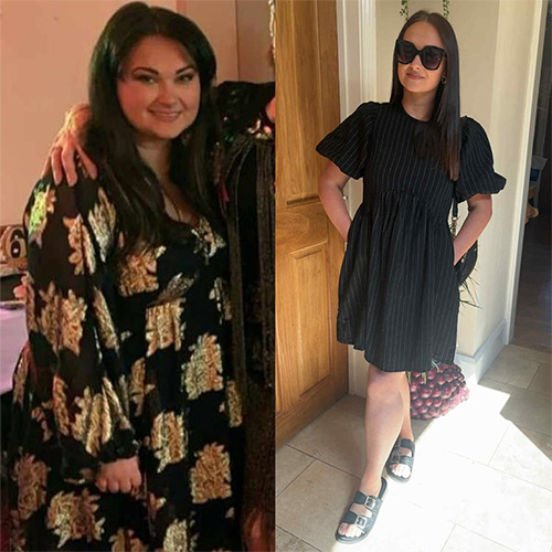 Whitley Lloyd before and after